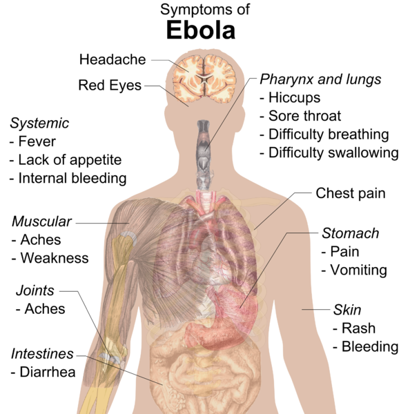 Ebola Wikipedia