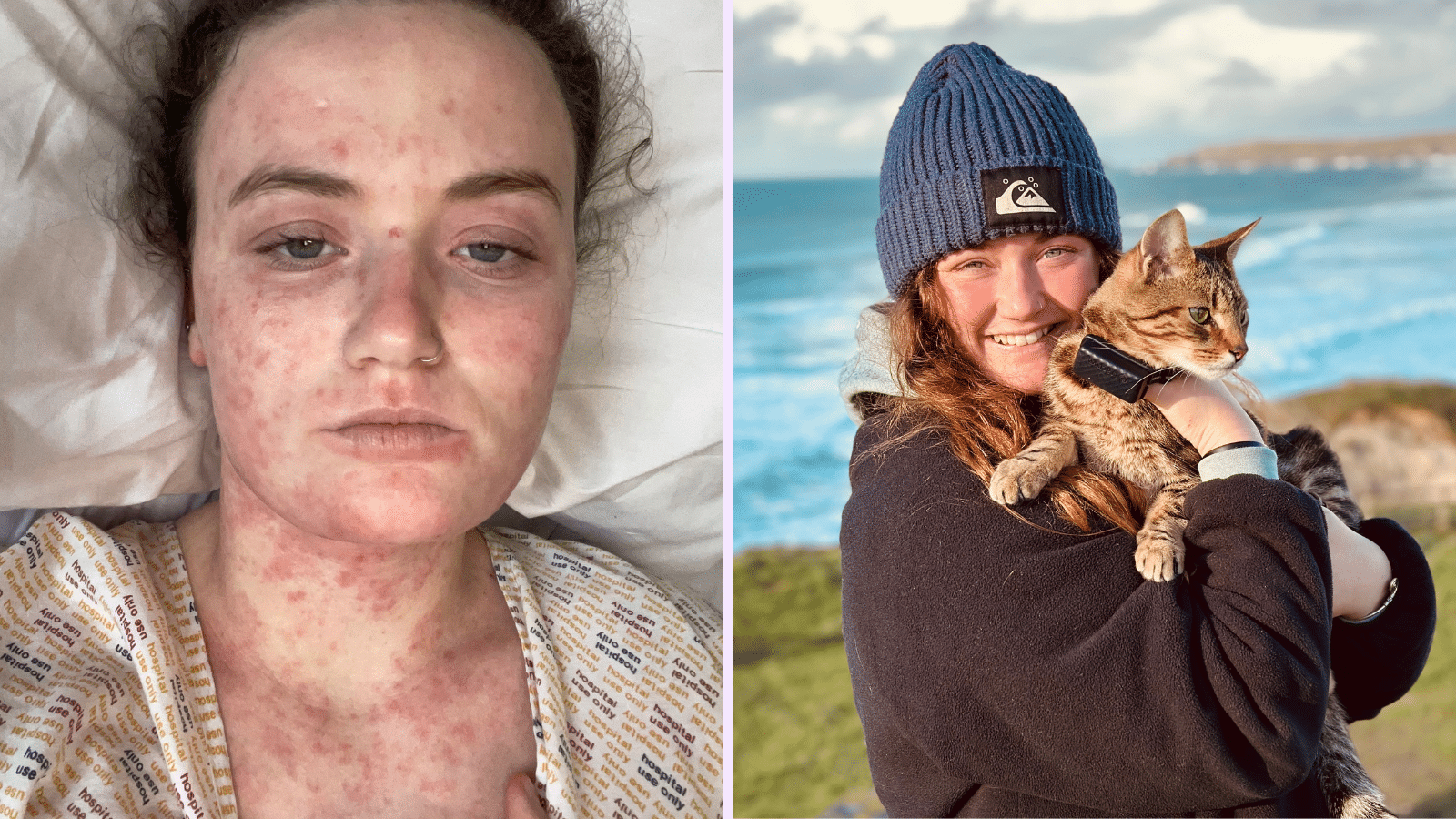 2026 JustGiving Awards finalist Skye Owen, shown left in bed, and shown right smiling and holding a cat